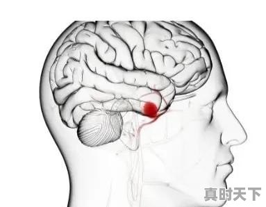 脑中风会因为天气变化导致吗？注意哪些 - 真时天下